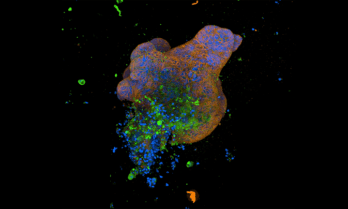 Cambridge University lab grown "mini guts" study